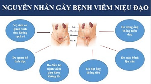 Nguyên nhâNguyên nhân viêm niệu đạon viêm niệu đạo